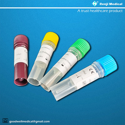 CE Novel Coronavirus Antigen Test Kit Complete results 40-90 mins